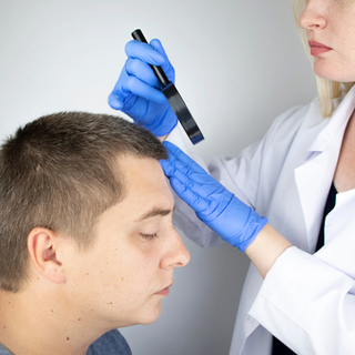 تشخيص داء الثعلبة تشخيص داء الثعلبة