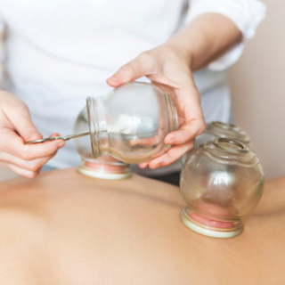 ما هي الحجامة؟ ما هي الحجامة؟