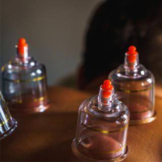 الحجامة وأمراض القلب وجهاز الدوران. الحجامة وأمراض القلب وجهاز الدوران.