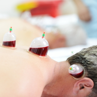 أضرار الحجامة. أضرار الحجامة.