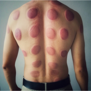 إلى متى يستمر ظهور الكدمات؟ إلى متى يستمر ظهور الكدمات؟