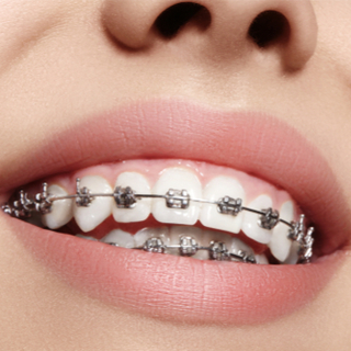 التقويم التقليدي