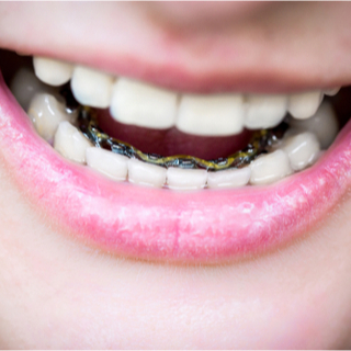 التقويم اللساني التقويم اللساني