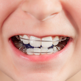 غطاء الرأس غطاء الرأس