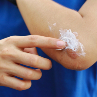 استخدم المضاد الحيوي استخدم المضاد الحيوي