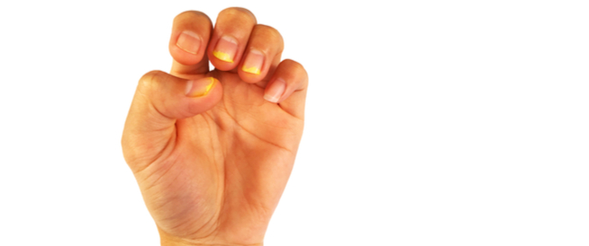 tbl_articles_article_27147_604f3d3d4bb-73d0-4f87-9d76-ca77e28072b5 تنظيف الأظافر من الاصفرار: طرق ووصفات طبيعية