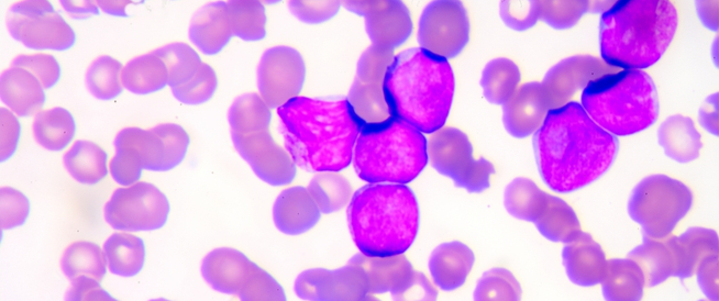 tbl_articles_article_27160_061459a3f-bd15-469a-a48f-622ea5d32478 الثلاسيميا الصغرى: دليلك الشامل