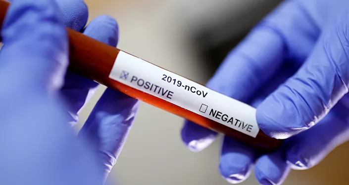 عينة دم تحمل فيروس كورونا عينة دم تحمل فيروس كورونا