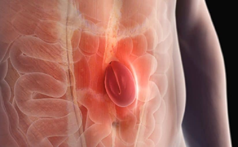 d8a7d8b3d8a8d8a7d8a8-d8a7d984d981d8aad8a7d982-825x510-2 اسباب الفتاق