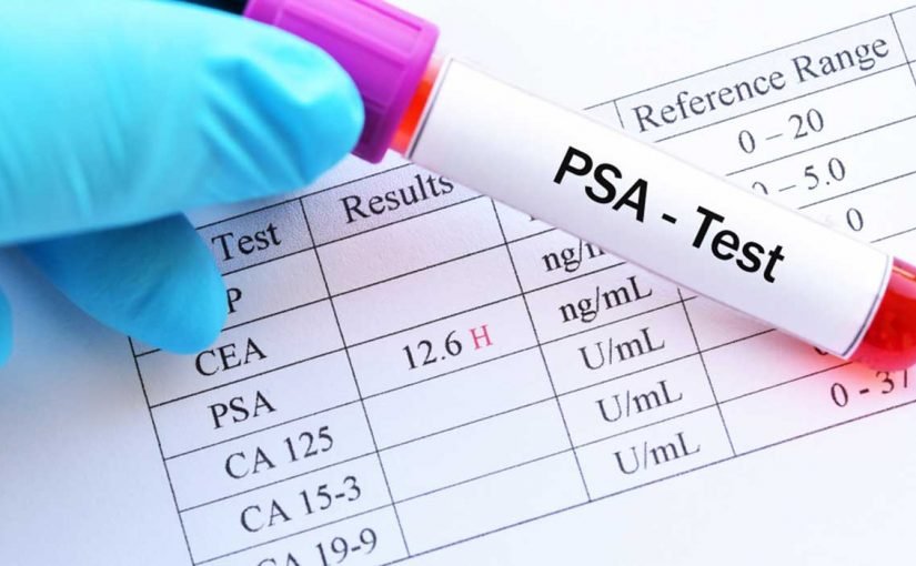 d8aad8add984d98ad984-d8a7d984d8afd985-d98ad981d8b7d8b1-d8a7d984d8b5d8a7d8a6d985-d8a7d985-d984d8a71-825x510-2 تحليل الدم يفطر الصائم ام لا