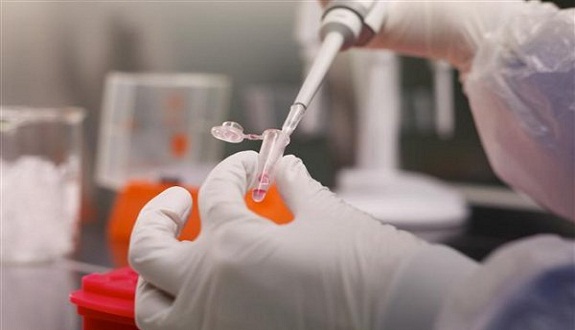 images_marea-ossra_lab_work-5 وزارة الصحة.. فيروسات الأنفلونزا المسجلة بالمغرب تبقى عادية