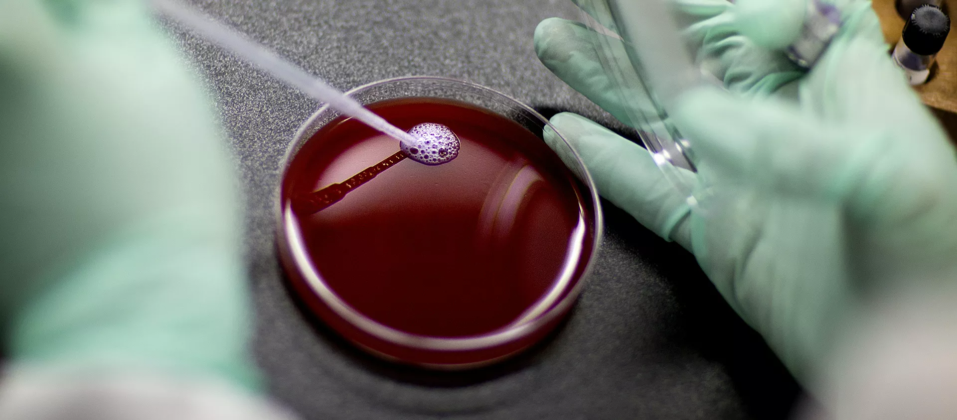 مختبر الدم - سبوتنيك عربي, 1920, 06.04.2021