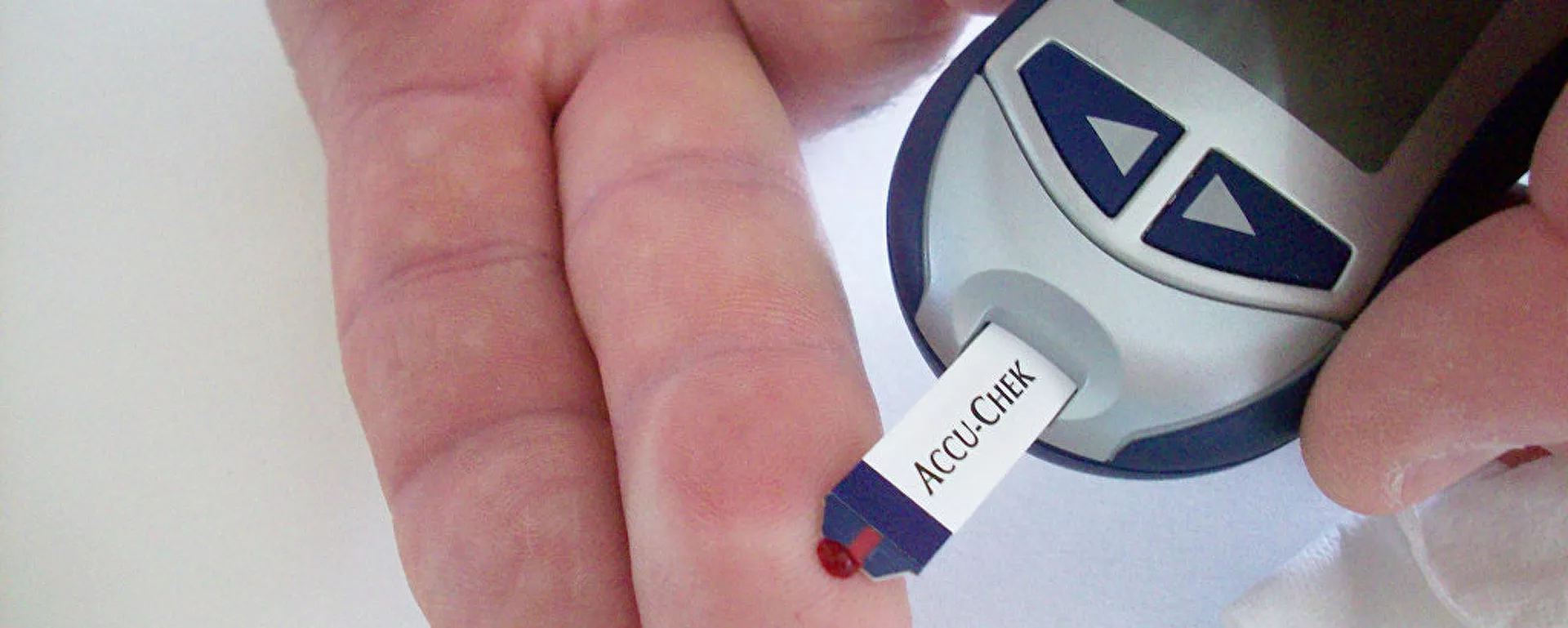 دراسة : مرض السكري هو نتيجة طفرة جينية - سبوتنيك عربي, 1920, 16.04.2021