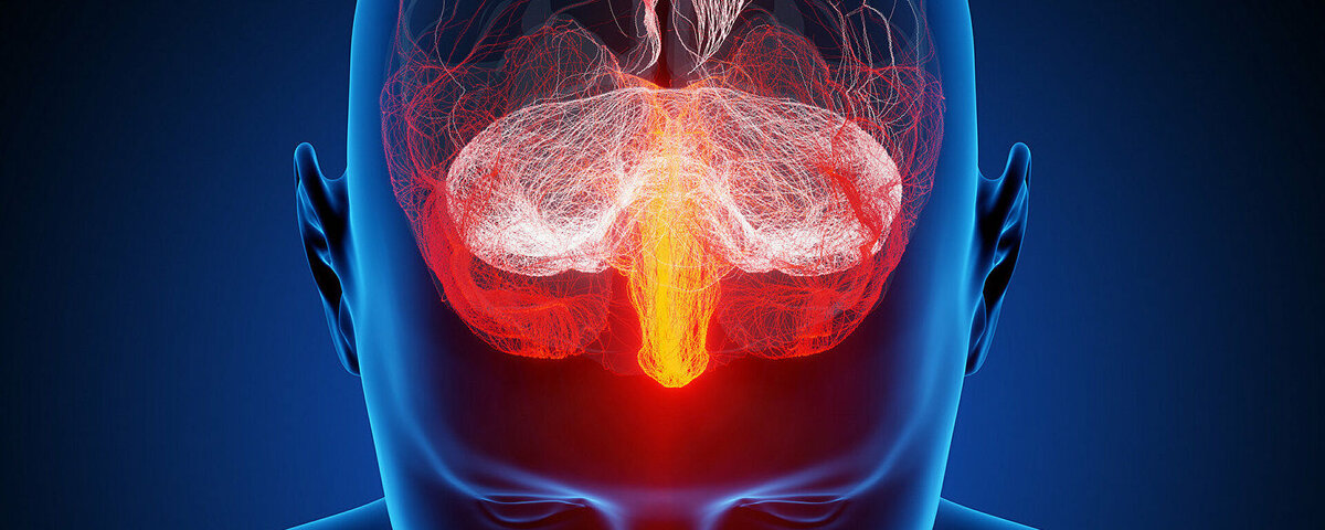 سرطان الدماغ  - سبوتنيك عربي, 1920, 07.07.2021