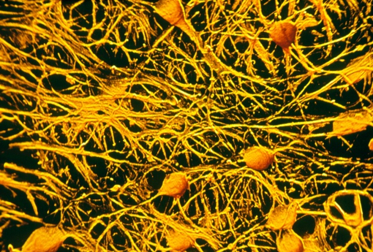 7_illaftrain_0768bec9f090a62b7864667105c5805d2c1571e4_181485587c31428b3a802a0e81de04e6