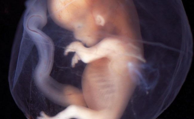 d987d984-d98ad8afd981d986-d8a7d984d8acd986d98ad986-d981d98a-d8b9d985d8b1-d8b4d987d8b1d98ad986-650x400-1 هل يدفن الجنين في عمر شهرين