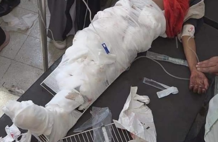 مقتل 3 أطفال يمنيين بقصف مجهول لحي سكني في تعز