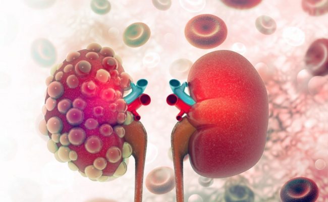 أعراض الفشل الكلوي عند الاطفال