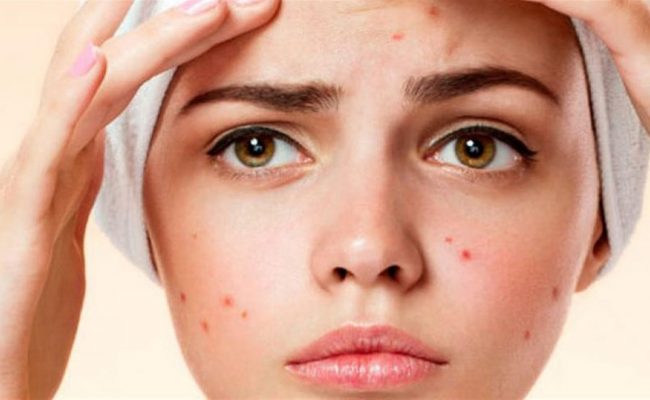 أنواع الحبوب الجلدية الخطيرة