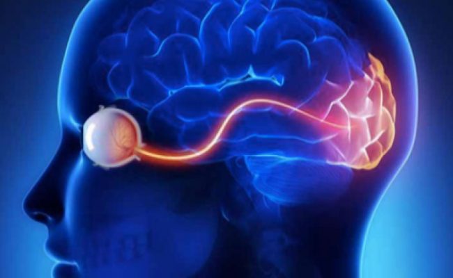 تجربتي مع التهاب العصب البصري