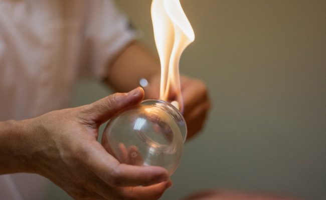 تجربتي مع حجامة الراس للمس