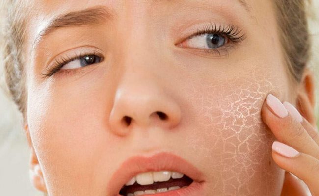 أدوية لعلاج جفاف الجلد