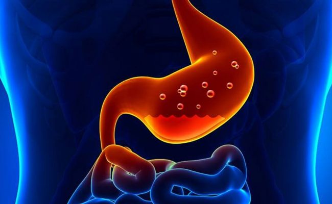 علاج حرقة المعدة في الطب النبوي