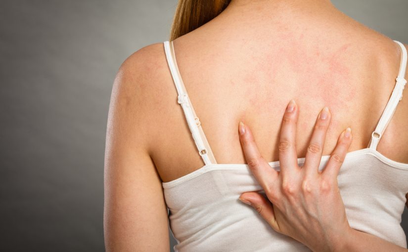 علاج فطريات الجلد