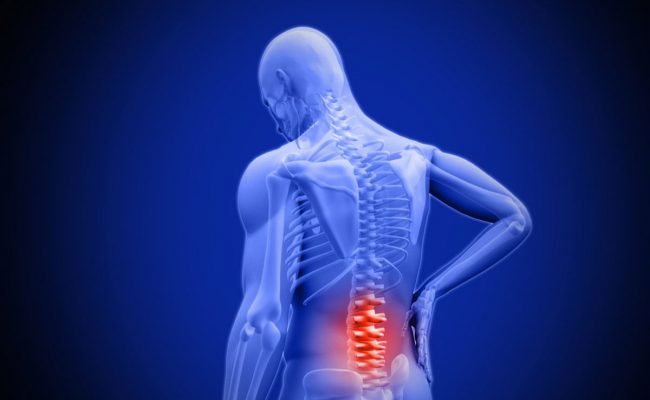 مدة الشفاء من عملية الانزلاق الغضروفي