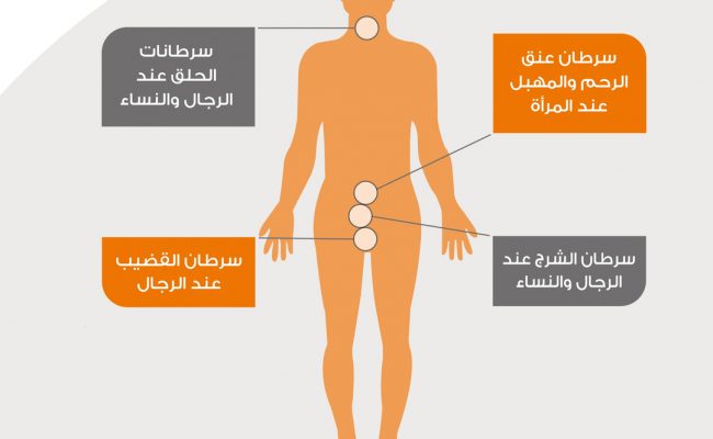 ما هو الورم الحليمي
