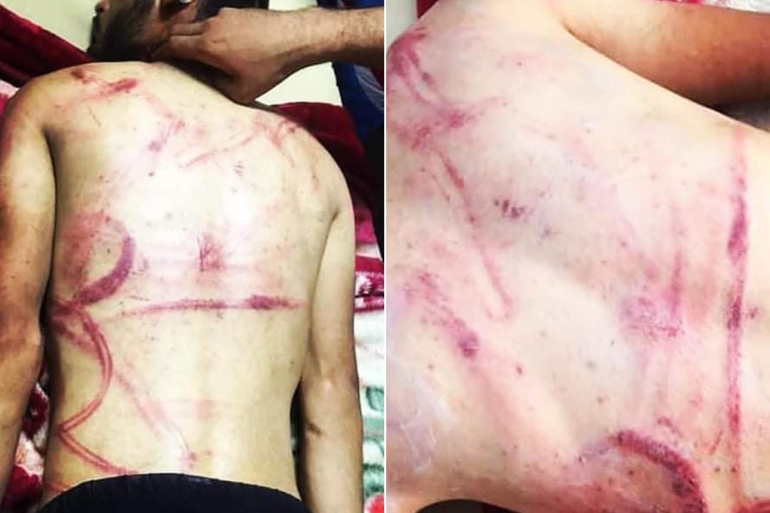 3-69 *** للاستخدام الداخلي فقط *** رصد المركز العراقي لتوثيق جرائم الحرب وفاة 28 معتقلا منذ مطلع 2022 بسبب التعذيب والإهمال الطبي - مواقع التواصل