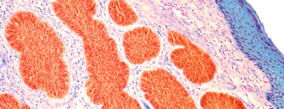 جراحة موس التصويرية الدقيقة